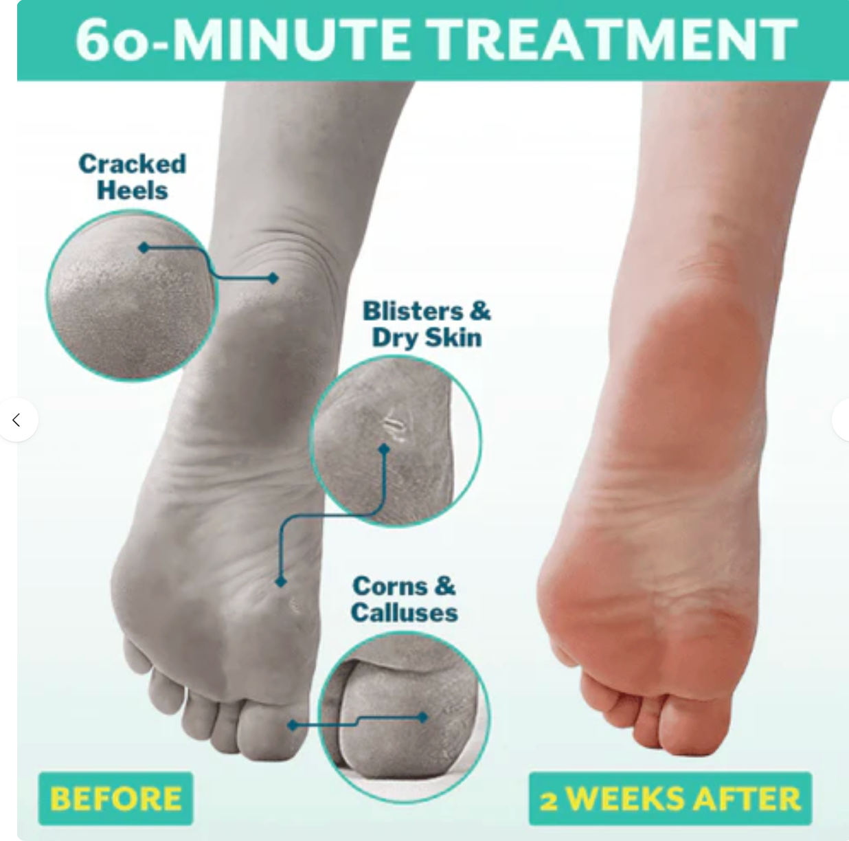 POSHPEEL™ Pedi Cure